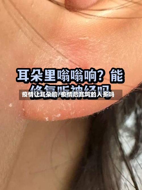 疫情让耳朵响/疫情后耳鸣的人多吗