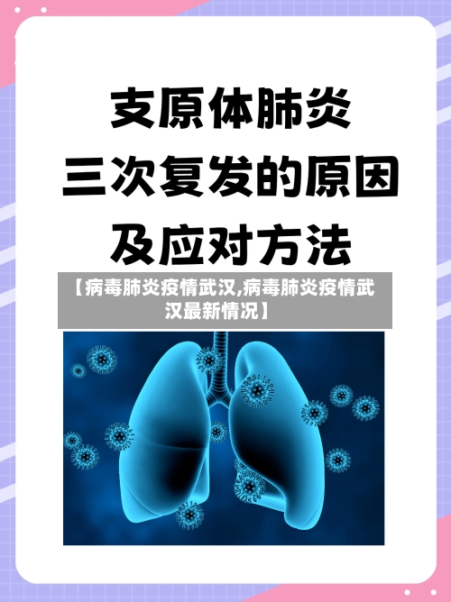 【病毒肺炎疫情武汉,病毒肺炎疫情武汉最新情况】-第3张图片