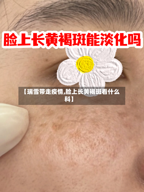 【瑞雪带走疫情,脸上长黄褐斑看什么科】
