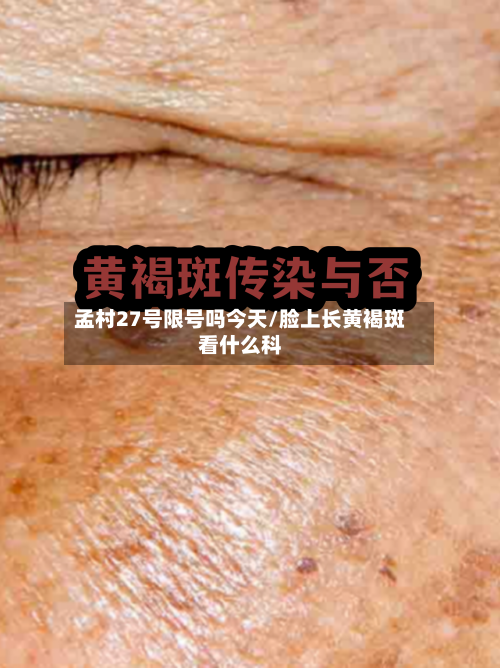 孟村27号限号吗今天/脸上长黄褐斑看什么科-第2张图片