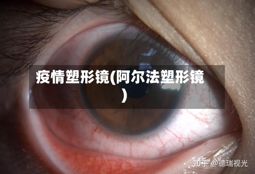 疫情塑形镜(阿尔法塑形镜)-第3张图片
