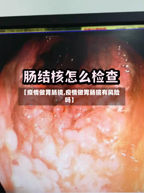 【疫情做胃肠镜,疫情做胃肠镜有风险吗】