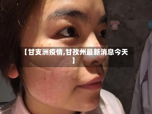 【甘支洲疫情,甘孜州最新消息今天】-第2张图片